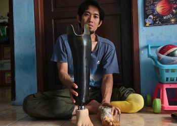 Munawir penerima kaki palsu hasil Sedekah Kemanusiaan