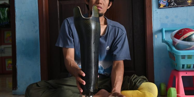 Munawir penerima kaki palsu hasil Sedekah Kemanusiaan