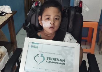 Rasya, penderita epilepsi + cerebral palsy+ skoliosis, telah menerima Sedekah Kemanusiaan