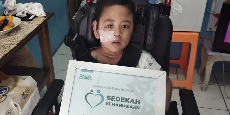 Rasya, penderita epilepsi + cerebral palsy+ skoliosis, telah menerima Sedekah Kemanusiaan